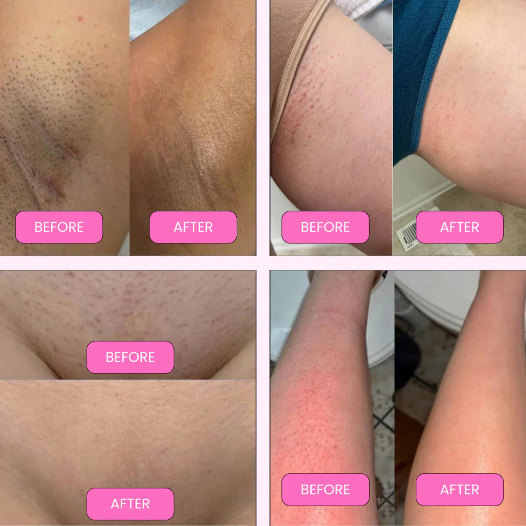 Lustrexy Bikini Shaver