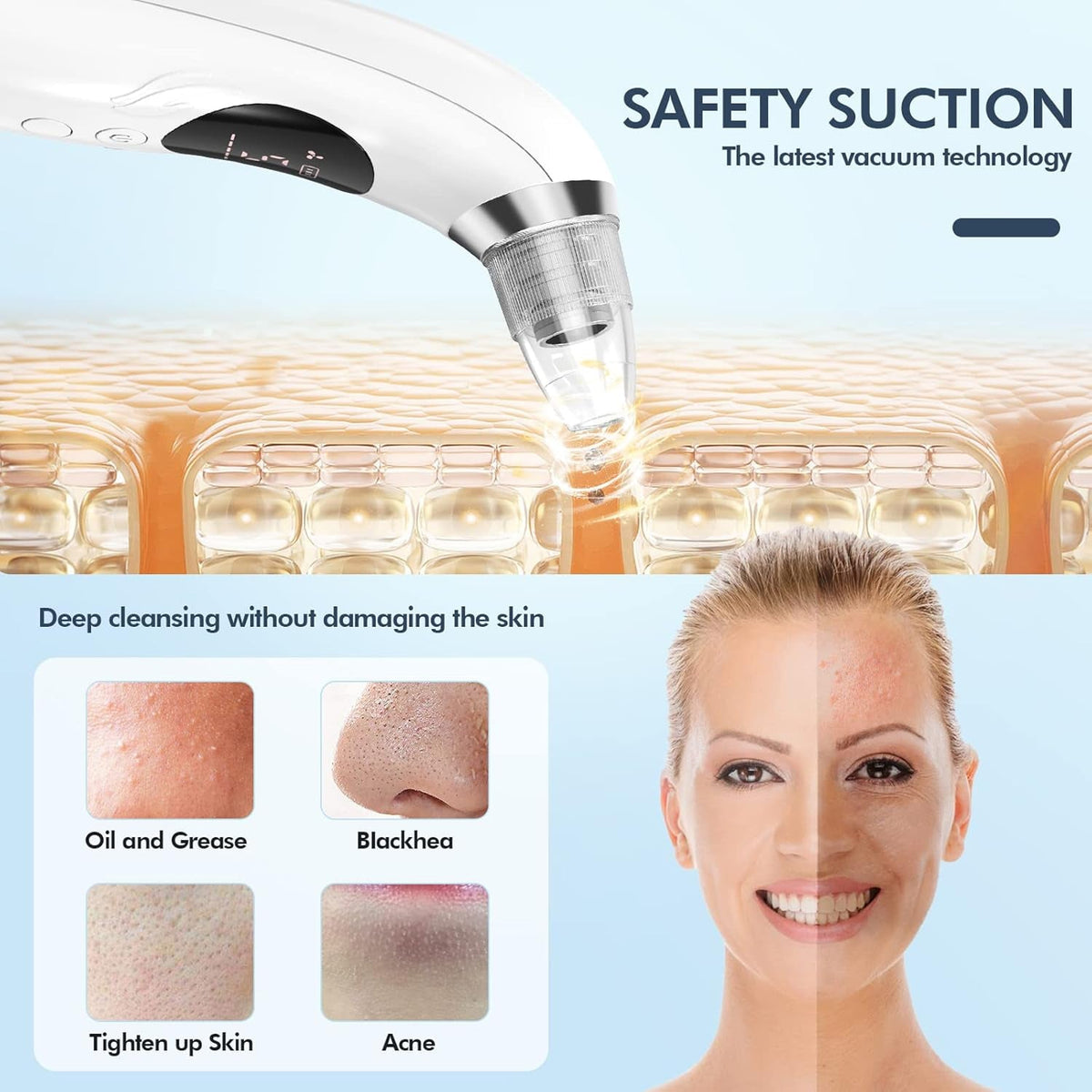 NixPorema Blackhead Remover