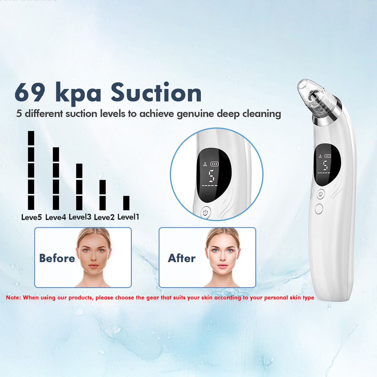 NixPorema Blackhead Remover