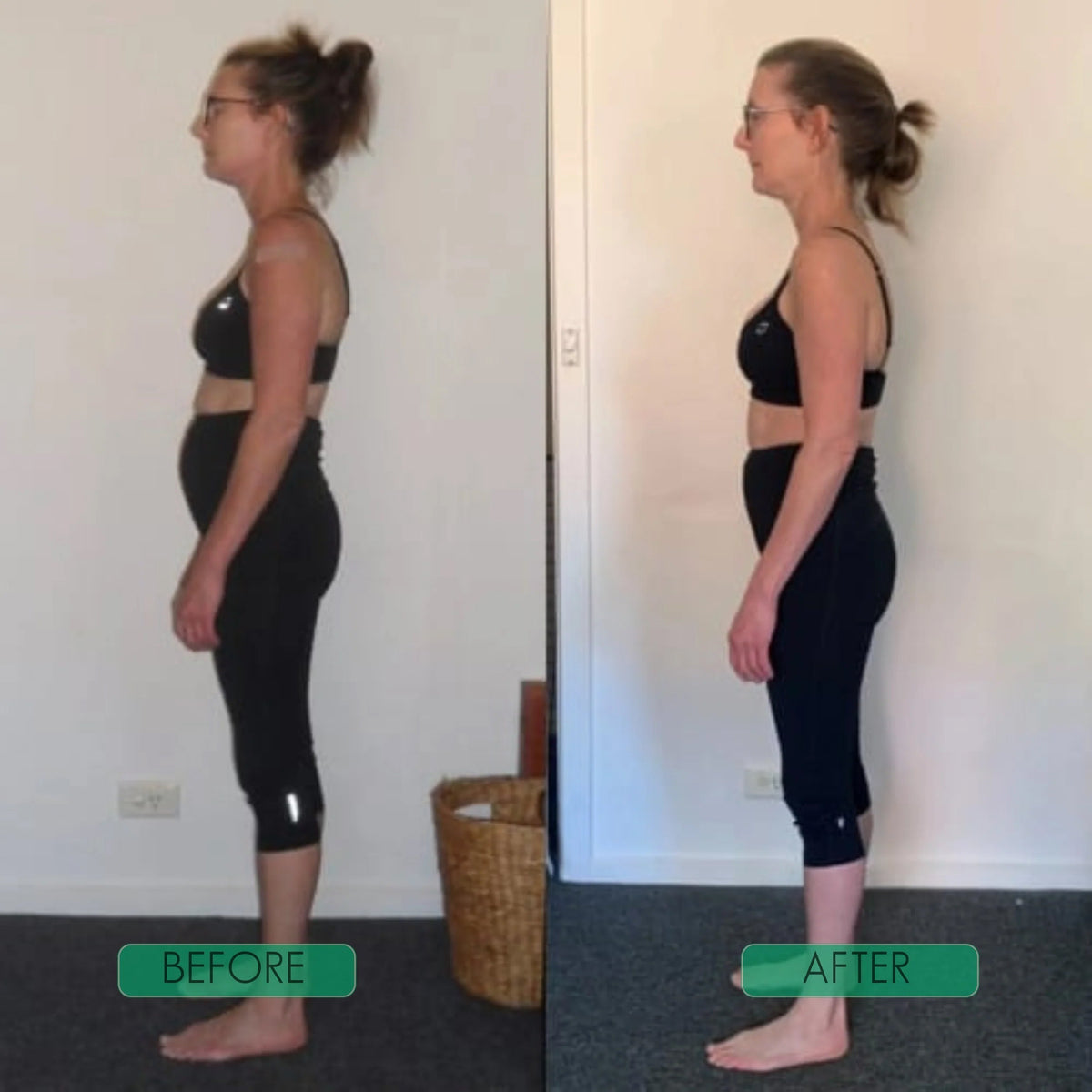 Postrixmer Posture Corrector For Scoliosis
