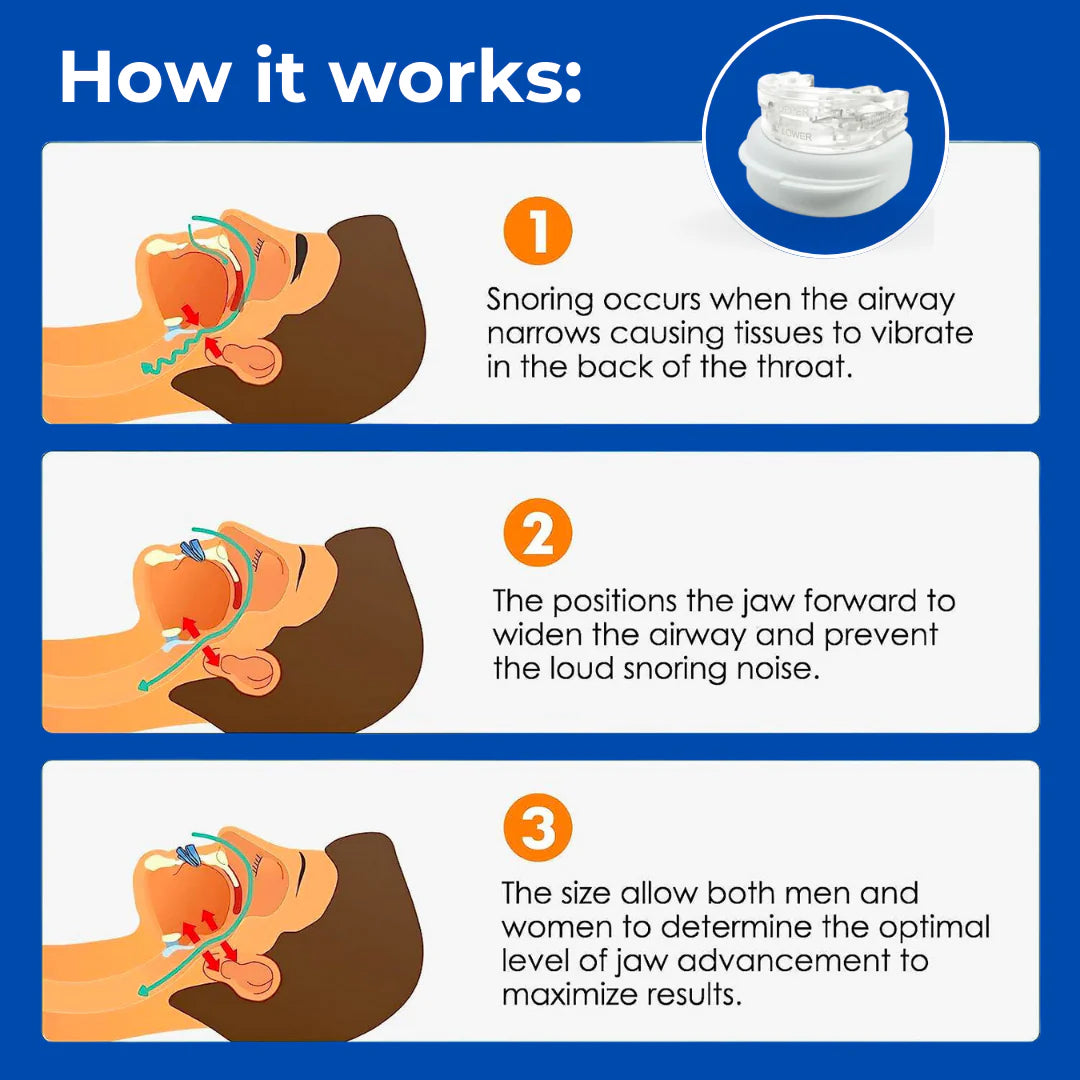 Quietmex Night Guard for Bruxism