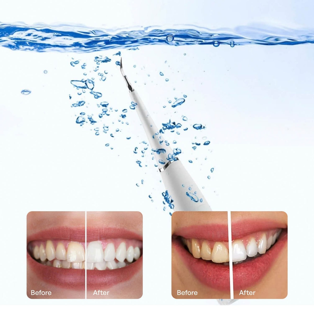 Zamoxque Plaque Remover